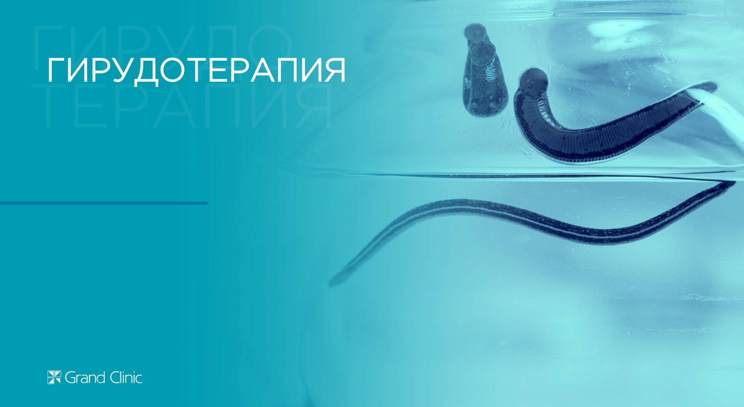 Смотреть видео о процедуре Гирудотерапия